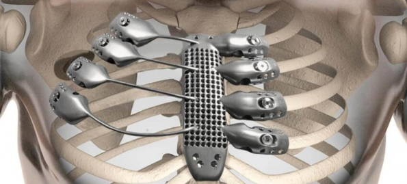 کاربرد پزشکی پودر تیتانیوم Titanium در چاپ سه بعدی 